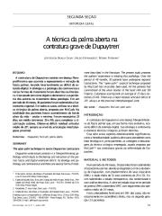 1999 - a técnica da palma aberta na contratura grave de dupuytren.pdf